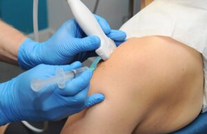 Unlocking Relief: Hyaluronic Acid Injection for Knee Pain
